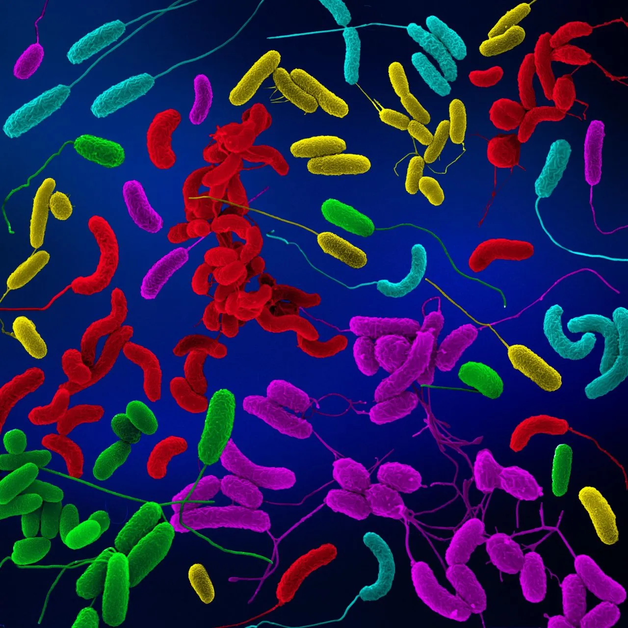 diverse pathogenic Vibrio species in red, blue, yellow, and green
