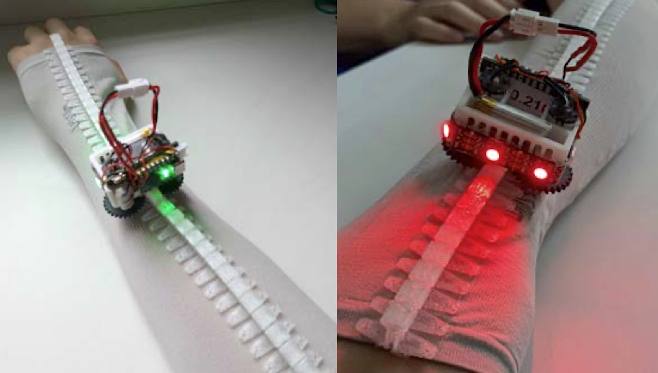 wearable mini robot running along track on person's arm