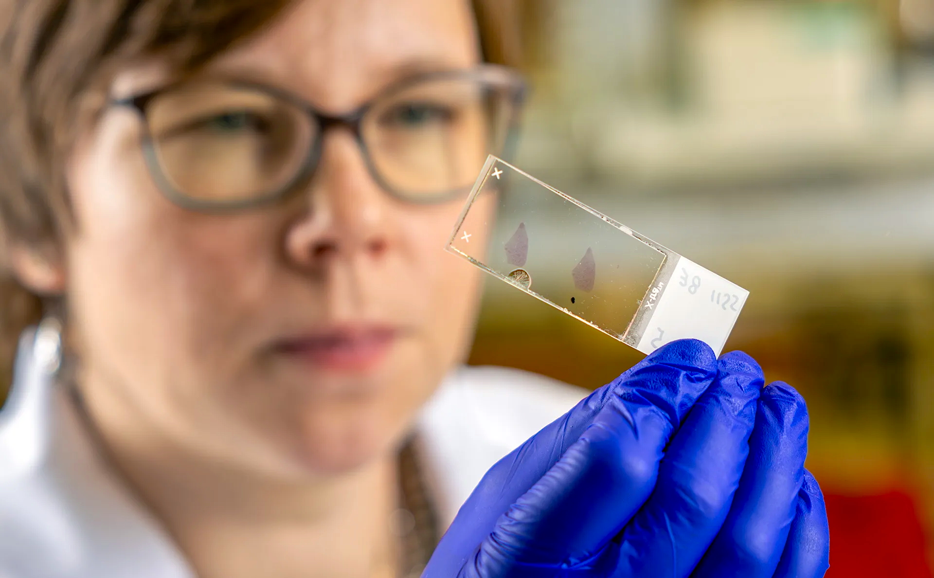 Maisel, holding lung tissue samples