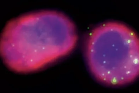 Phages (green) are shown engulfed by alveolar macrophages (cytoskeleton in pink and nucleus in blue).