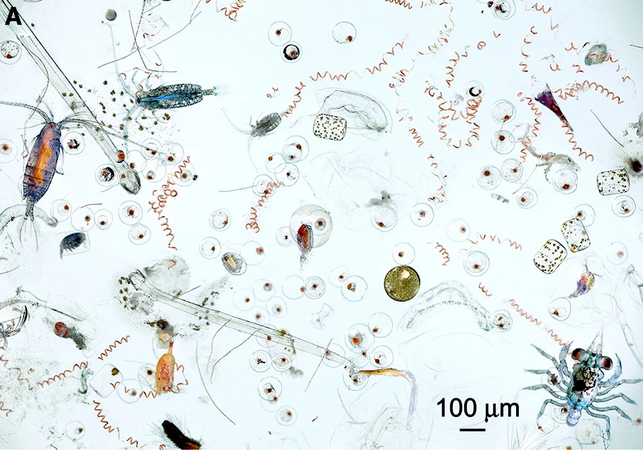 Marine microplankton from a sample off Kona, Hawaii. 