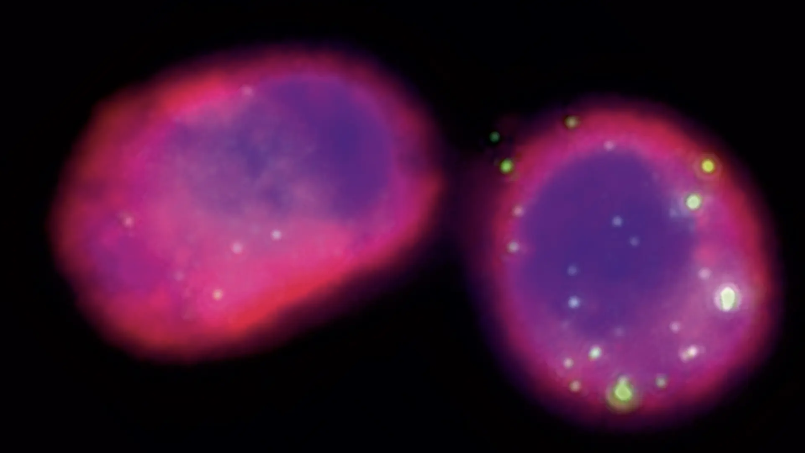 Phages (green) are shown engulfed by alveolar macrophages (cytoskeleton in pink and nucleus in blue).
